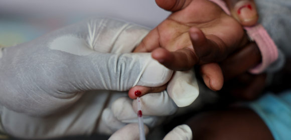 Especialista deixa cargo em programa de HIV nos EUA e critica abordagem de Trump